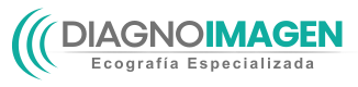 Ecografía de Tiroides