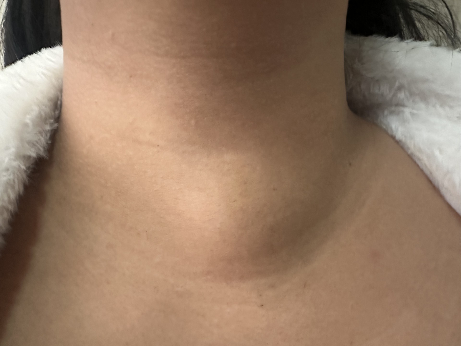 ECOGRAFÍA DE TIROIDES